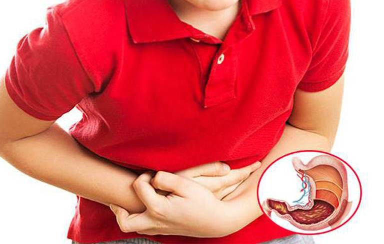 Viêm loét dạ dày gây ra triệu chứng đau dạ dày buồn nôn