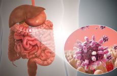 Viêm dạ dày ruột cấp tính có nguyên nhân chủ yếu do virus, vi khuẩn trong đường tiêu hóa